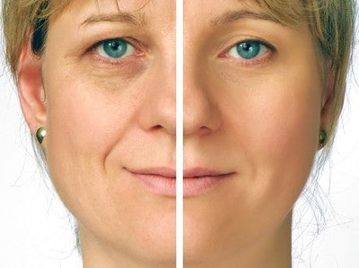 Best Combo-Argireline Matrixyl3000 Vitamin C Peptide Hyaluronic Acid
